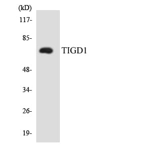 Western blot analysis of the lysates from HeLa cells using Anti-TIGD1 Antibody.
