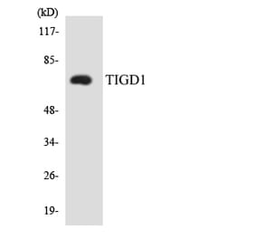 Western Blot - Anti-TIGD1 Antibody (R12-3624) - Antibodies.com
