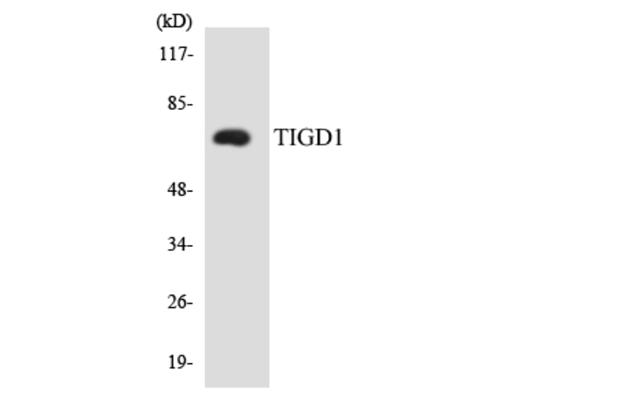 Western Blot - Anti-TIGD1 Antibody (R12-3624) - Antibodies.com