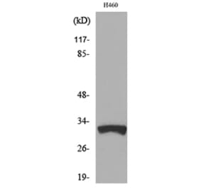 Western Blot - Anti-TFPI2 Antibody (C30040) - Antibodies.com