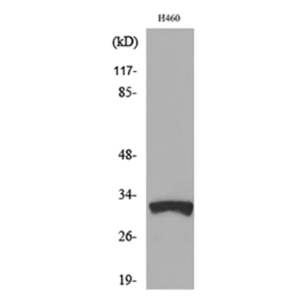 Western Blot - Anti-TFPI2 Antibody (C30040) - Antibodies.com