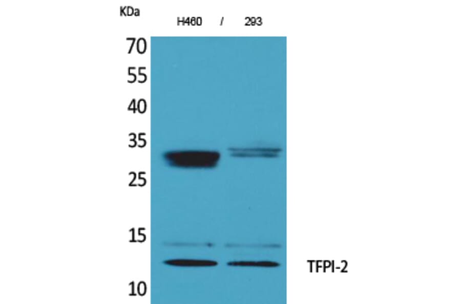 Western Blot - Anti-TFPI2 Antibody (C30040) - Antibodies.com