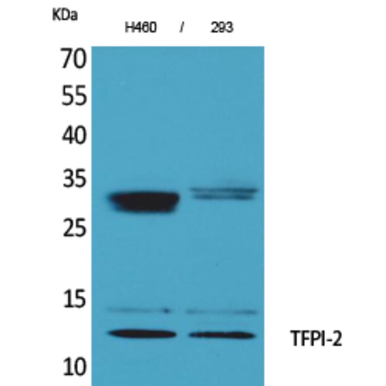 Western Blot - Anti-TFPI2 Antibody (C30040) - Antibodies.com