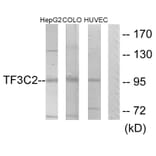 Western Blot - Anti-TF3C2 Antibody (C11403) - Antibodies.com