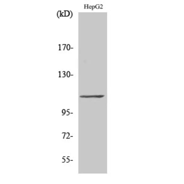 Western Blot - Anti-TF3C2 Antibody (C11403) - Antibodies.com