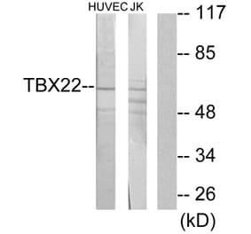 Western Blot - Anti-TBX22 Antibody (C11954) - Antibodies.com