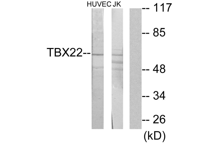 Western Blot - Anti-TBX22 Antibody (C11954) - Antibodies.com