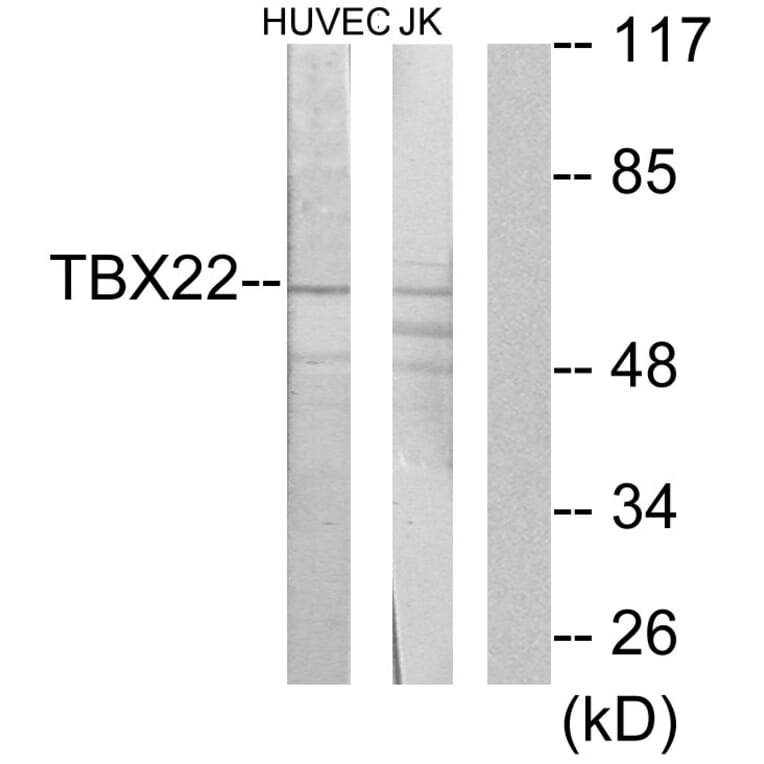 Western Blot - Anti-TBX22 Antibody (C11954) - Antibodies.com