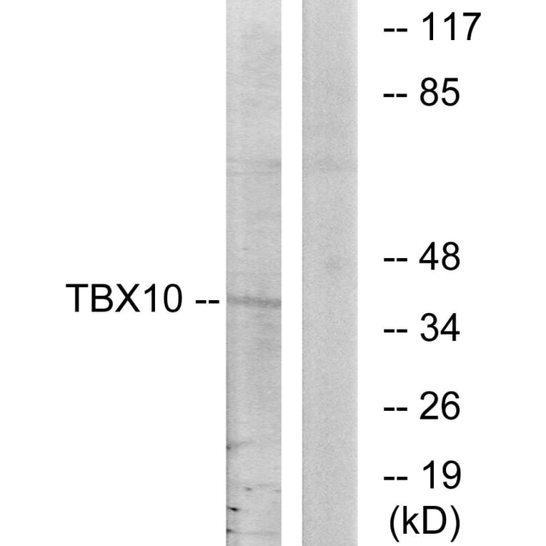 Western Blot - Anti-TBX10 Antibody (C10164) - Antibodies.com