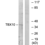 Western Blot - Anti-TBX10 Antibody (C10164) - Antibodies.com