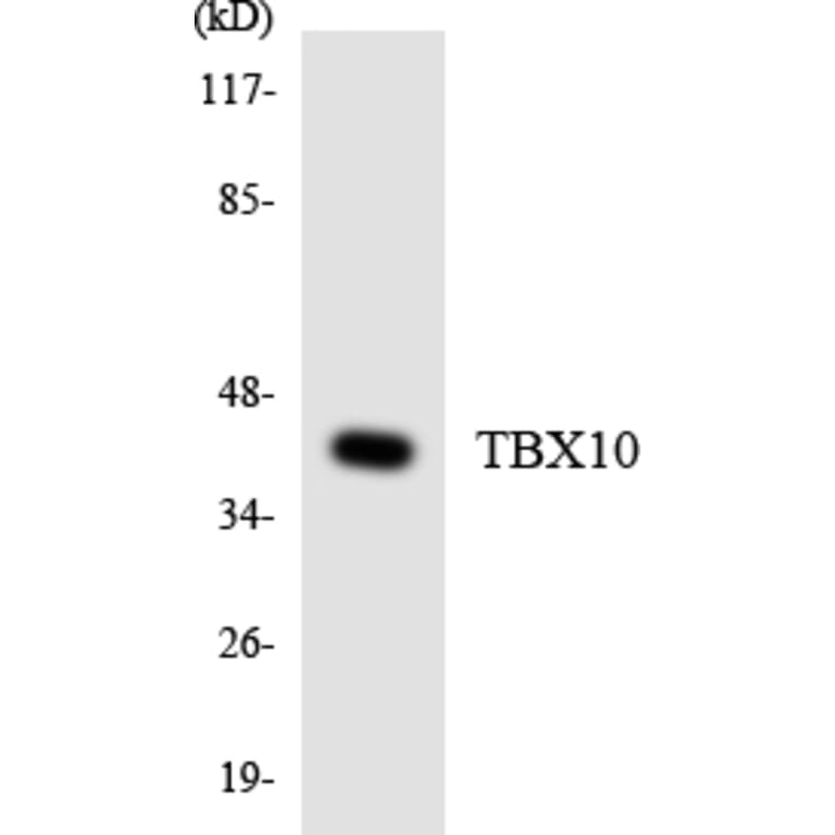 Western Blot - Anti-TBX10 Antibody (R12-3603) - Antibodies.com
