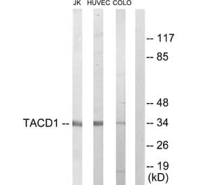 Western Blot - Anti-TACD1 Antibody (C10390) - Antibodies.com