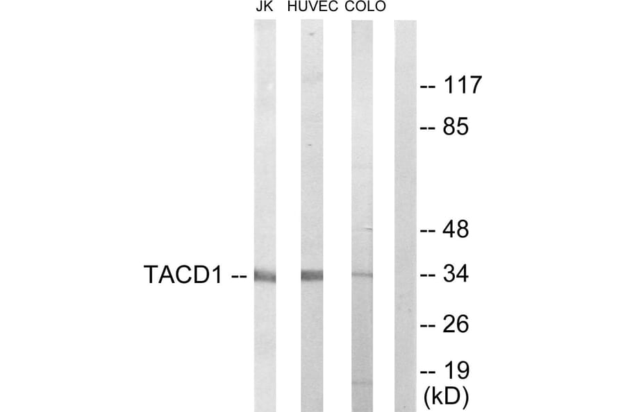 Western Blot - Anti-TACD1 Antibody (C10390) - Antibodies.com