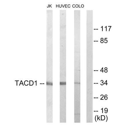 Western Blot - Anti-TACD1 Antibody (C10390) - Antibodies.com