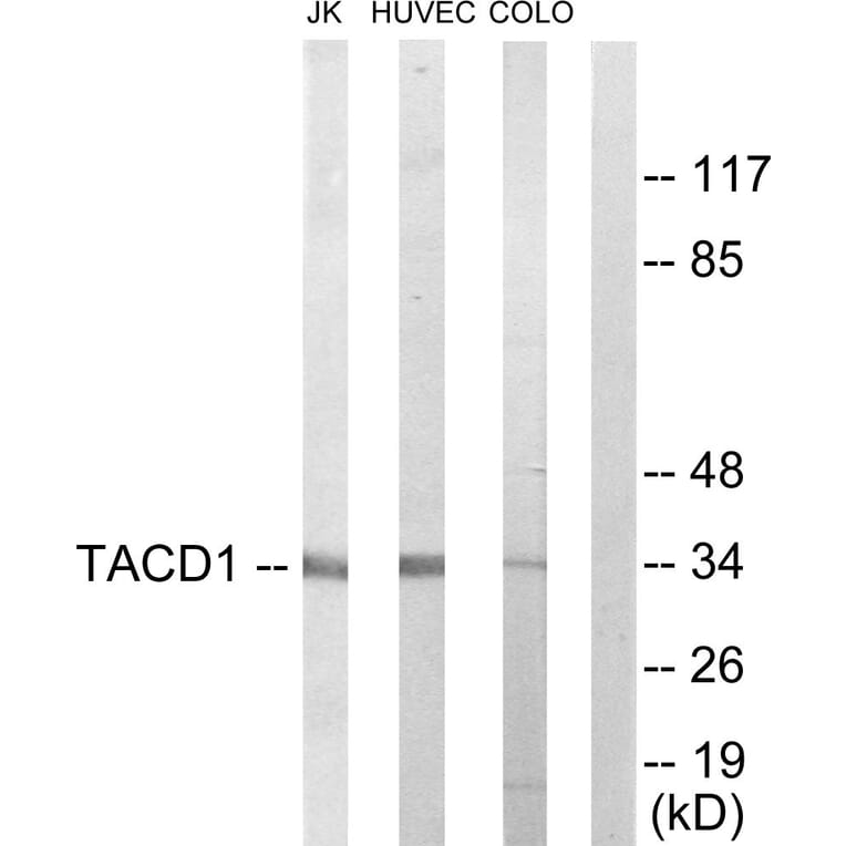 Western Blot - Anti-TACD1 Antibody (C10390) - Antibodies.com