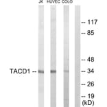 Western Blot - Anti-TACD1 Antibody (C10390) - Antibodies.com