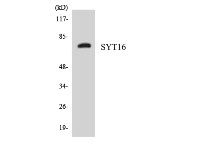 Western Blot - Anti-SYT16 Antibody (R12-3578) - Antibodies.com