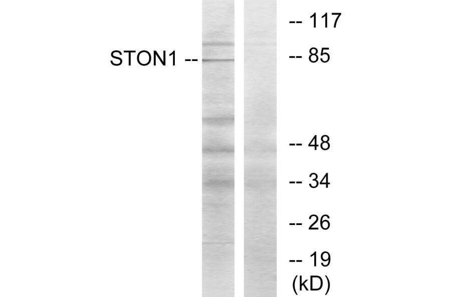 Western Blot - Anti-STON1 Antibody (C11991) - Antibodies.com