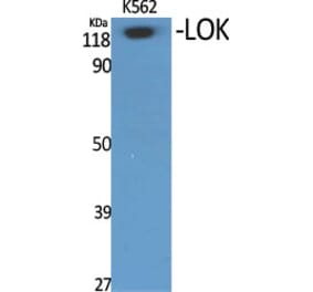 Western Blot - Anti-STK10 Antibody (C21152) - Antibodies.com