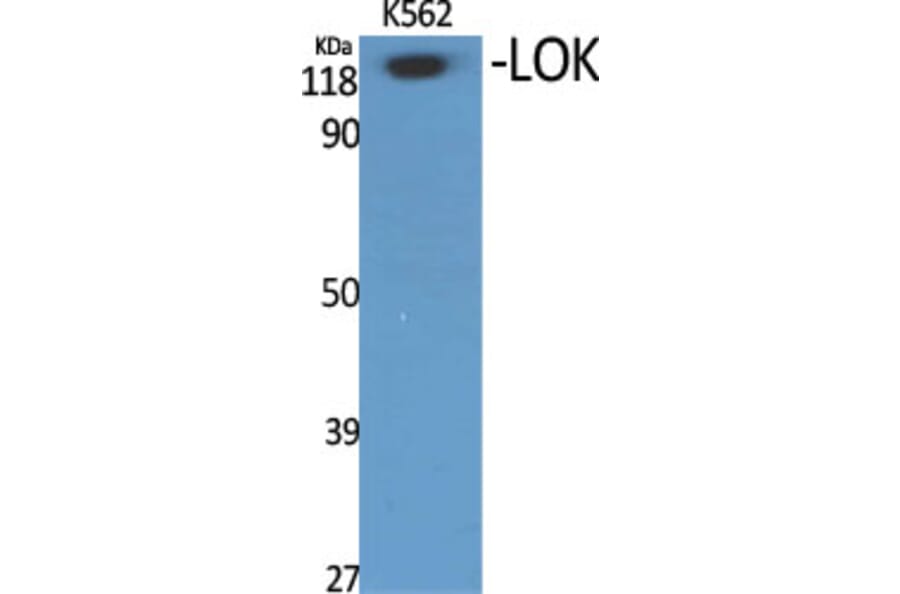 Western Blot - Anti-STK10 Antibody (C21152) - Antibodies.com