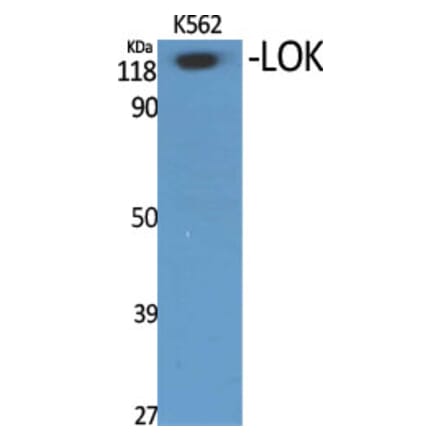 Western Blot - Anti-STK10 Antibody (C21152) - Antibodies.com