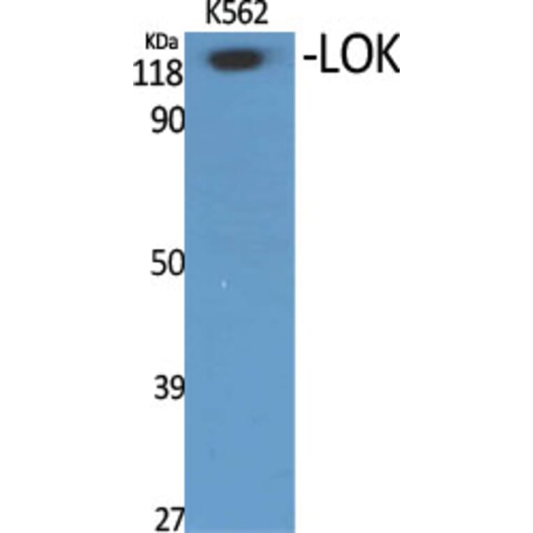 Western Blot - Anti-STK10 Antibody (C21152) - Antibodies.com