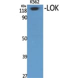 Western Blot - Anti-STK10 Antibody (C21152) - Antibodies.com