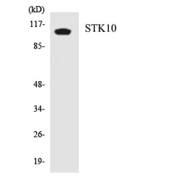 Western Blot - Anti-STK10 Antibody (R12-3568) - Antibodies.com