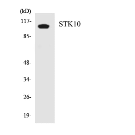 Western Blot - Anti-STK10 Antibody (R12-3568) - Antibodies.com