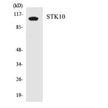 Western Blot - Anti-STK10 Antibody (R12-3568) - Antibodies.com