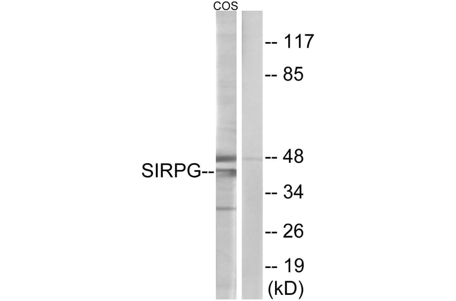 Western Blot - Anti-SIRPG Antibody (C18747) - Antibodies.com