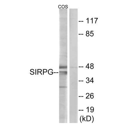 Western Blot - Anti-SIRPG Antibody (C18747) - Antibodies.com