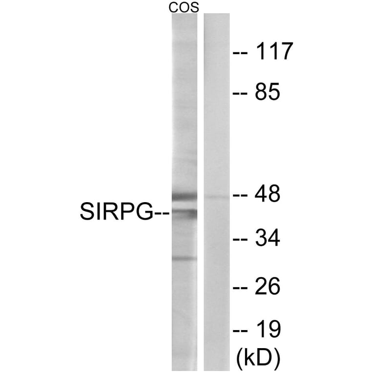 Western Blot - Anti-SIRPG Antibody (C18747) - Antibodies.com