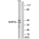 Western Blot - Anti-SIRPG Antibody (C18747) - Antibodies.com
