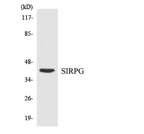 Western Blot - Anti-SIRPG Antibody (R12-3507) - Antibodies.com