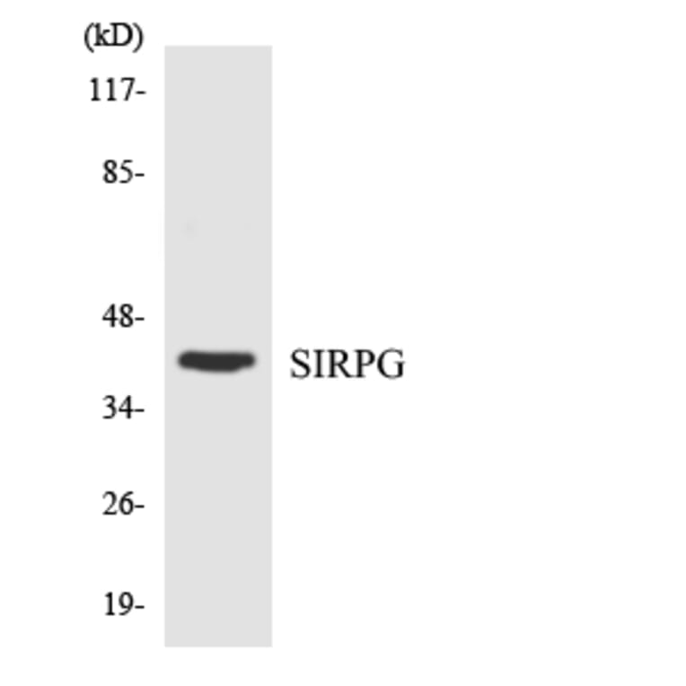 Western Blot - Anti-SIRPG Antibody (R12-3507) - Antibodies.com