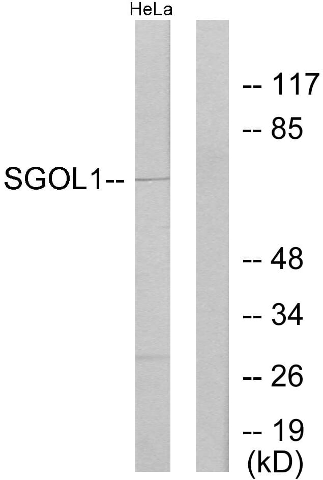 Western blot analysis of lysates from HeLa cells using Anti-SGOL1 Antibody. The right hand lane represents a negative control, where the antibody is blocked by the immunising peptide.