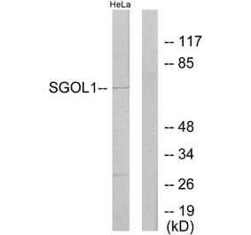 Western Blot - Anti-SGOL1 Antibody (C11176) - Antibodies.com