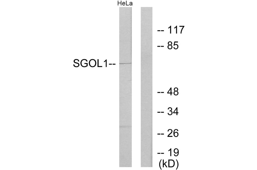 Western Blot - Anti-SGOL1 Antibody (C11176) - Antibodies.com