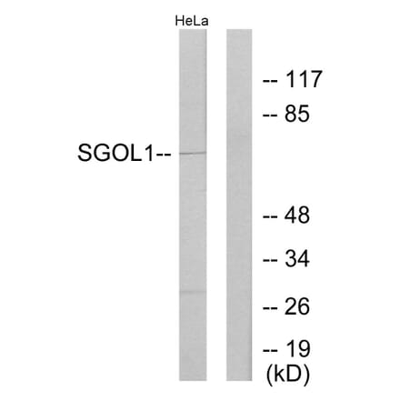 Western Blot - Anti-SGOL1 Antibody (C11176) - Antibodies.com