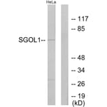 Western Blot - Anti-SGOL1 Antibody (C11176) - Antibodies.com