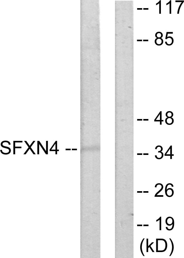 Western blot analysis of lysates from HUVEC cells using Anti-SFXN4 Antibody. The right hand lane represents a negative control, where the antibody is blocked by the immunising peptide.
