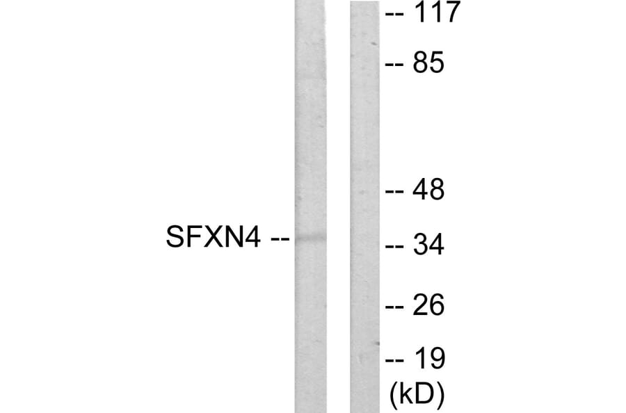 Western Blot - Anti-SFXN4 Antibody (C11227) - Antibodies.com