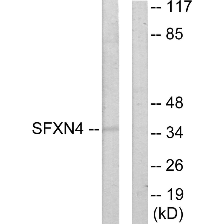 Western Blot - Anti-SFXN4 Antibody (C11227) - Antibodies.com