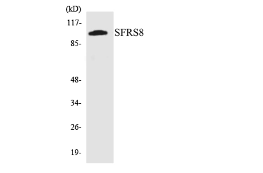Western Blot - Anti-SFRS8 Antibody (R12-3500) - Antibodies.com