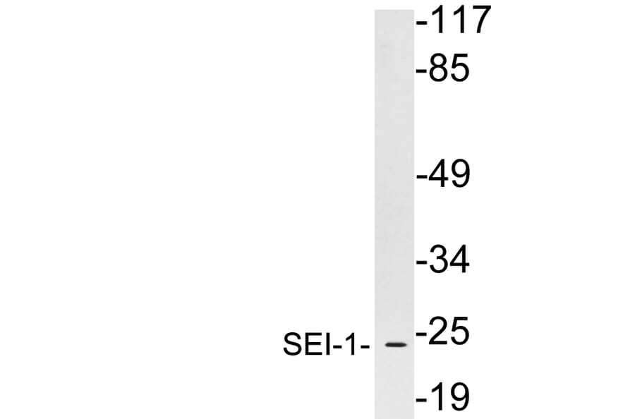 Western Blot - Anti-SEI-1 Antibody (R12-2350) - Antibodies.com