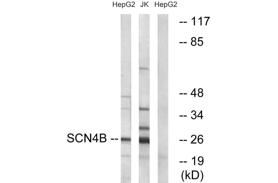 Western Blot - Anti-SCN4B Antibody (C18808) - Antibodies.com