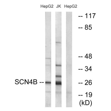 Western Blot - Anti-SCN4B Antibody (C18808) - Antibodies.com