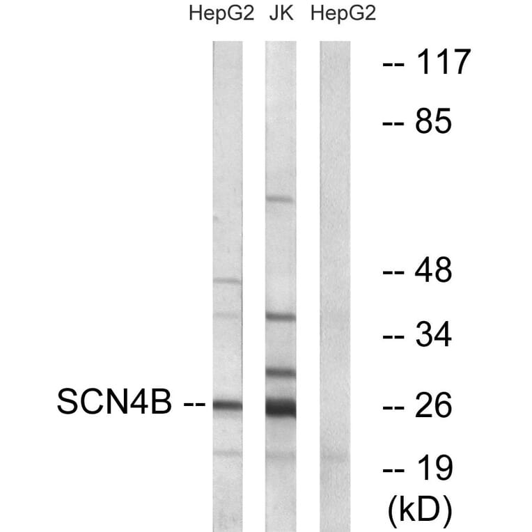 Western Blot - Anti-SCN4B Antibody (C18808) - Antibodies.com
