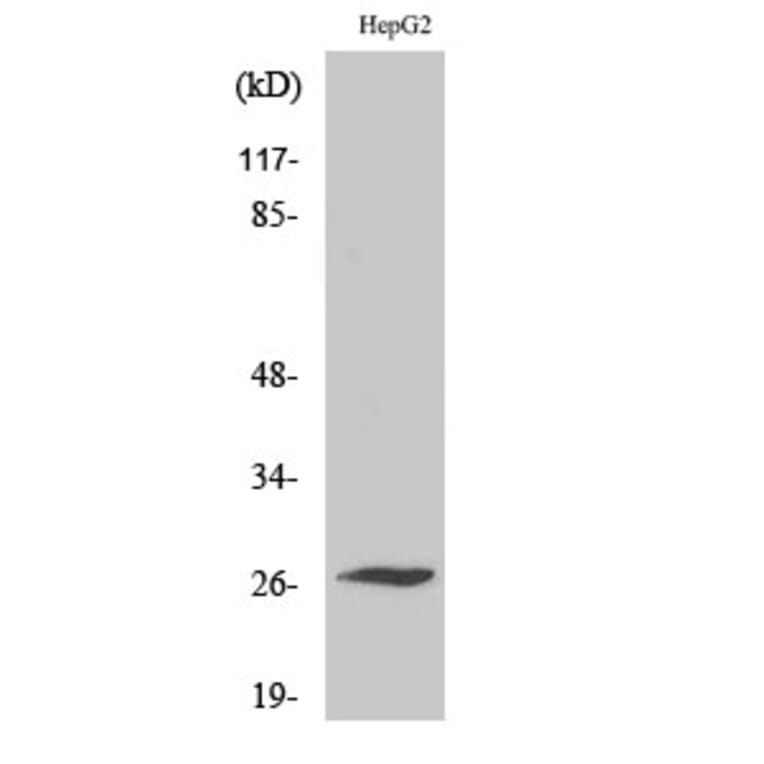 Western Blot - Anti-SCN4B Antibody (C18808) - Antibodies.com